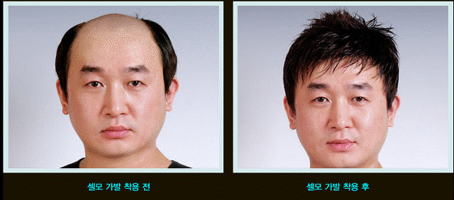 셀모가발 이미지