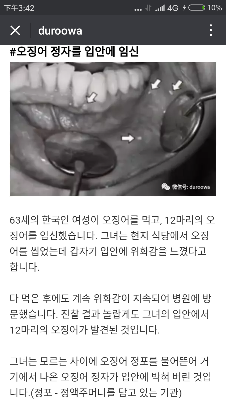 몸에서 나온 생명체들 (혐오주의) | 인스티즈