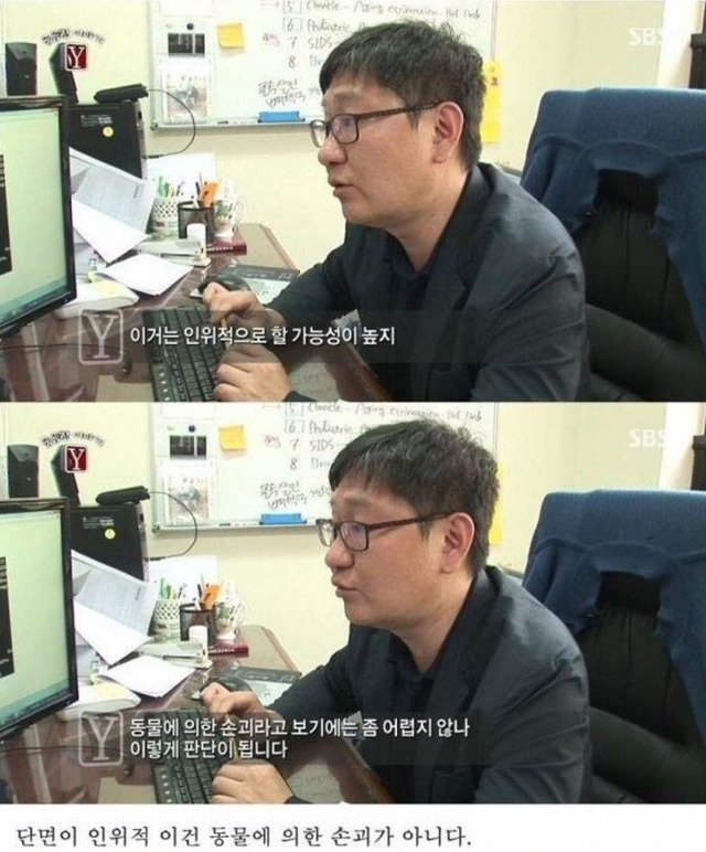 자고 일어나니 발가락이 모두 사라진 남자 | 인스티즈