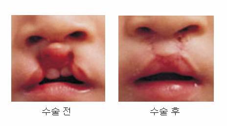당나귀를 탄 여의사.jpg | 인스티즈
