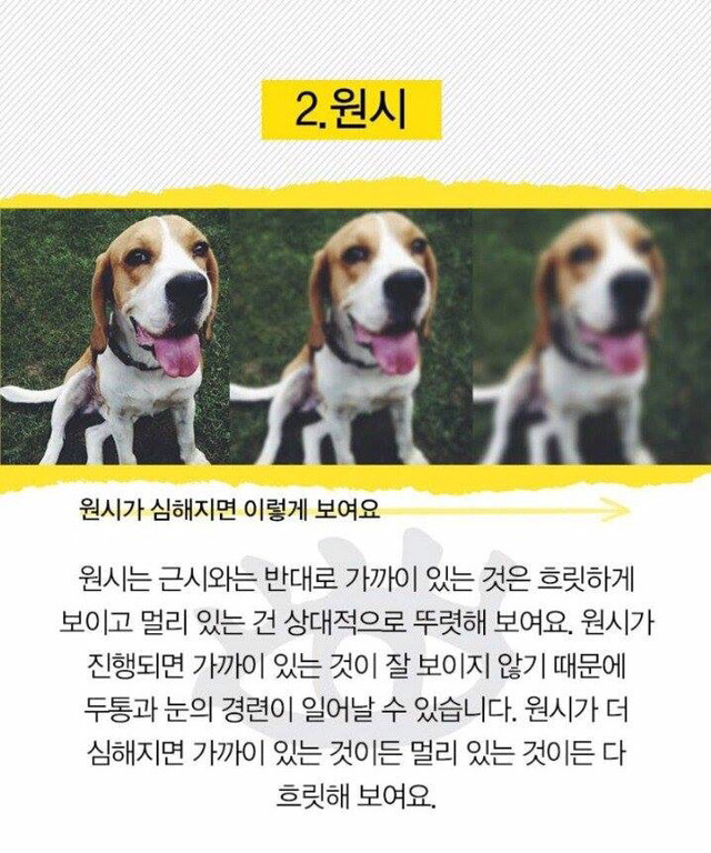 눈으로 알 수 있는 질병 | 인스티즈