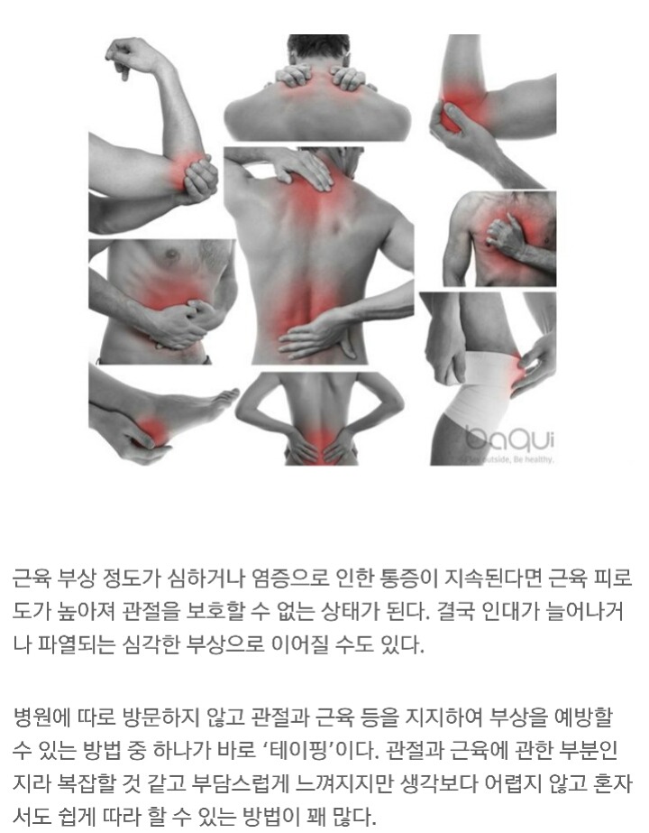 [다이어트칼럼] 알록달록 스포츠 테이핑, 왜 하는 거지? | 인스티즈
