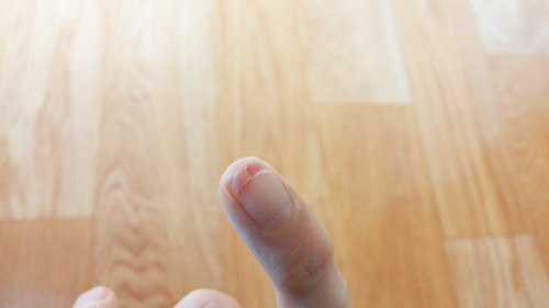 보기만 해도 고통이 전해지는 사진 | 인스티즈