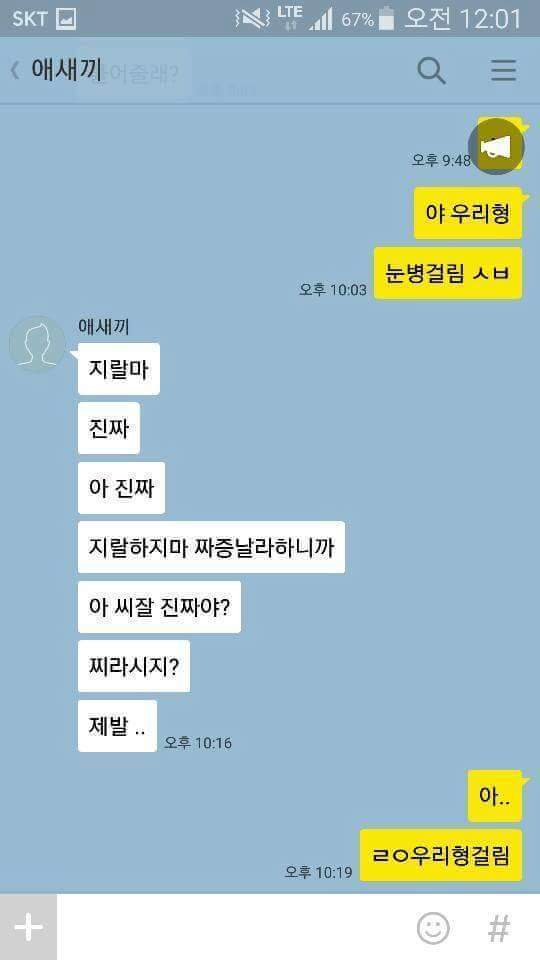 눈병걸린 우리형.jpg | 인스티즈