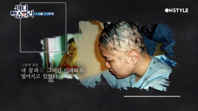 전신탈모증 윤사비나씨가 생각하는 아름다움.jpg | 인스티즈