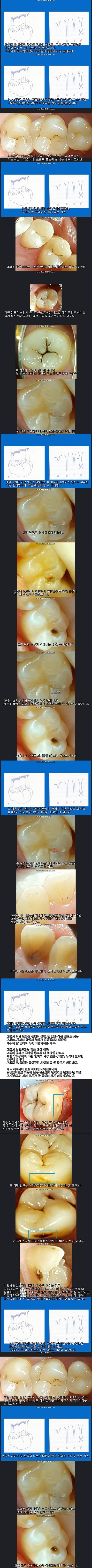 치아는 타고나는 것 (혐오주의) | 인스티즈