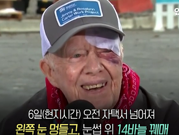 블랙아이 이미지